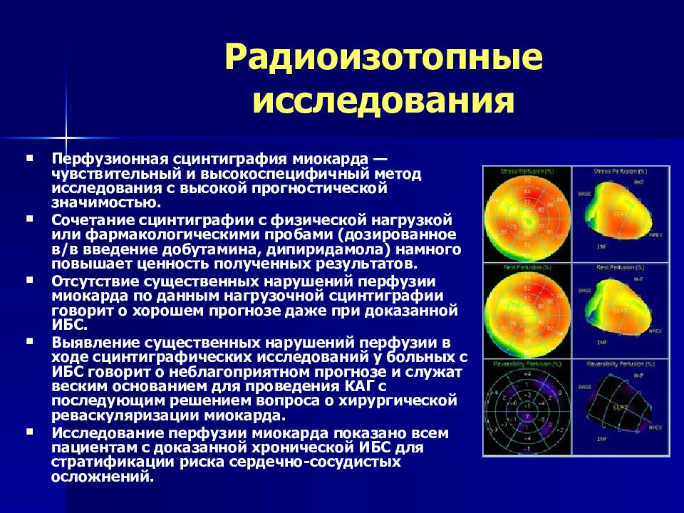 Презентация сцинтиграфия миокарда