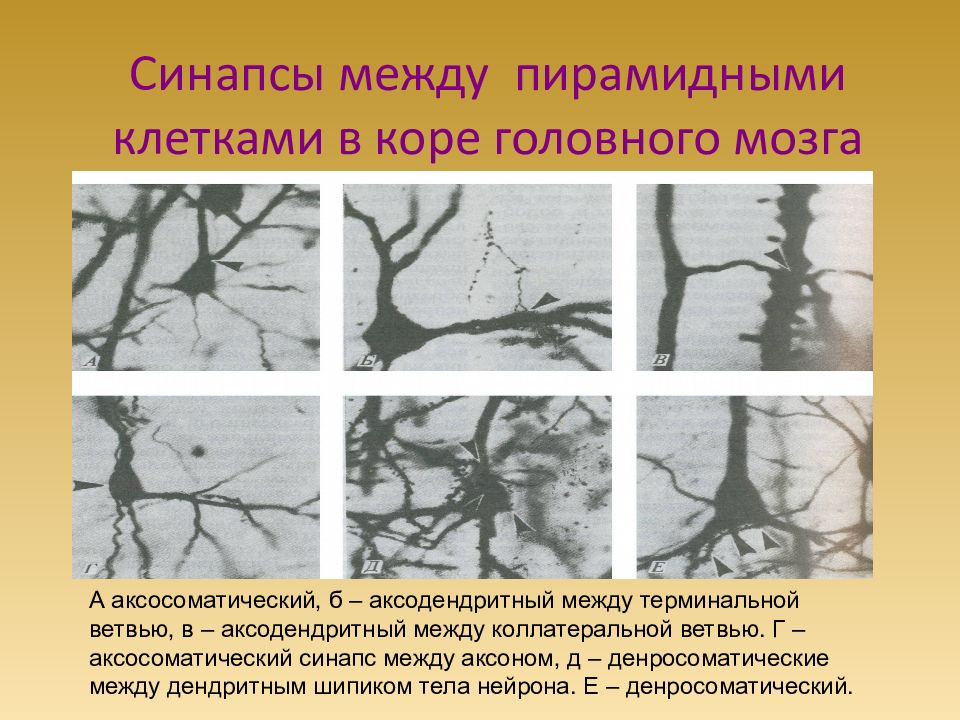 Аксосоматический синапс схема