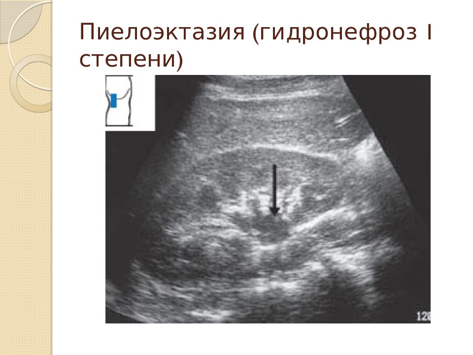 Презентация на тему узи