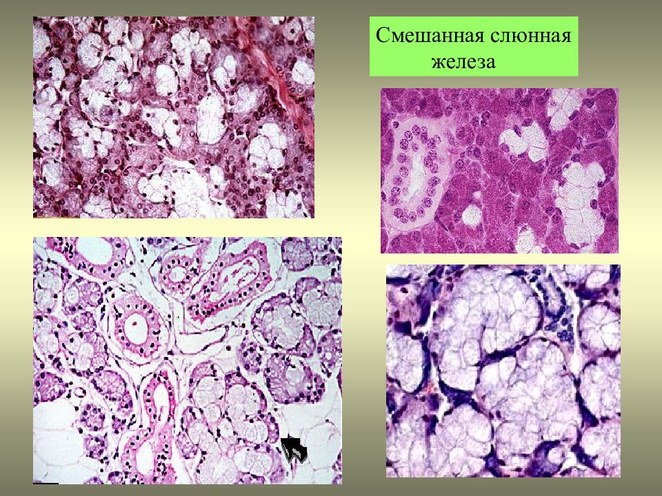 Секреция железистого эпителия. Железистый эпителий гистология препарат. Смешанная слюнная железа гистология. Железистый эпителий зеленая железа. Железистый эпителий микроскоп.
