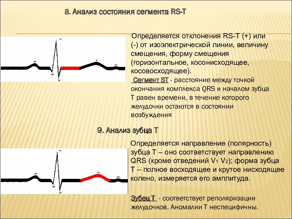 Основы экг презентация