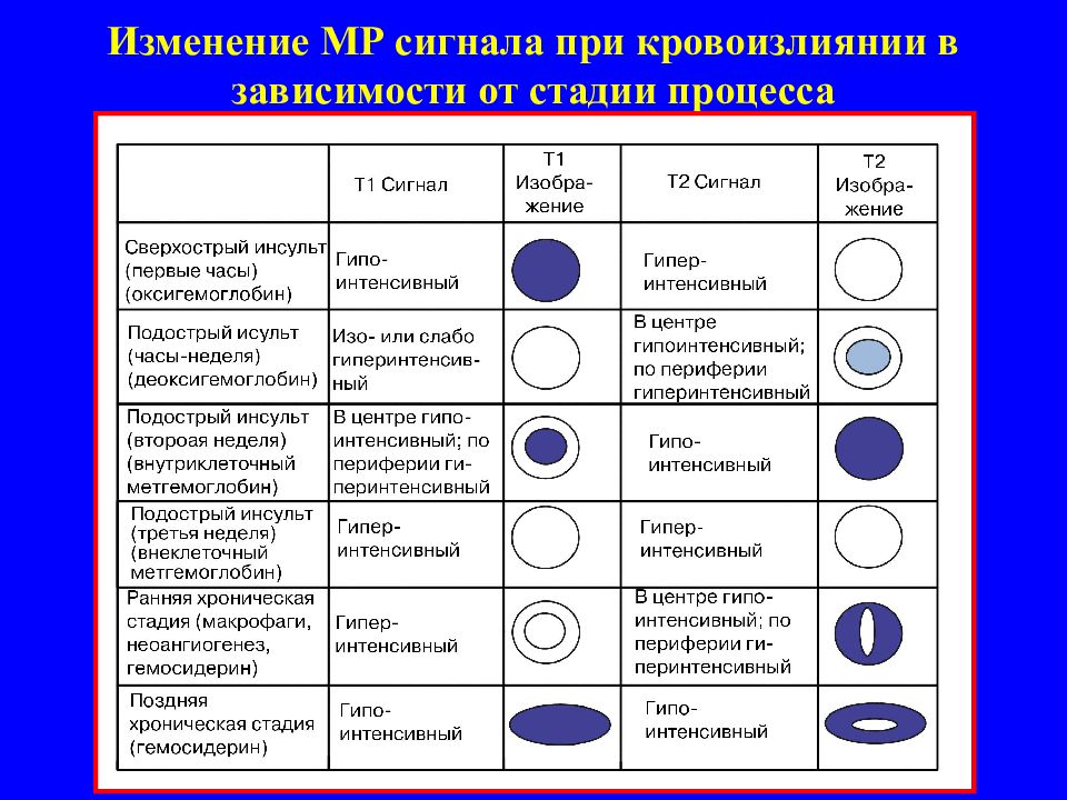 Сигналом что от данной. Мрт сигнальные характеристики. Таблица МР сигналов. Характеристики мрт сигнала. Гипер и гипоинтенсивный сигнал.