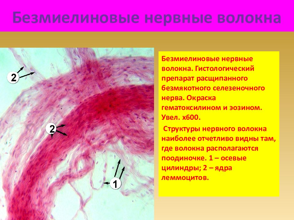 нервные волокна гистология препарат. нервные волокна гистология препарат. мякотные волокна препарат гистология. безмиелиновые нервные волокна препарат гистология. безмякотные нервные волокна препарат гистология.