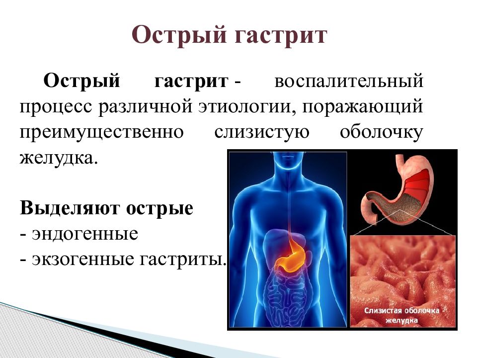 Острый и хронический гастрит презентация