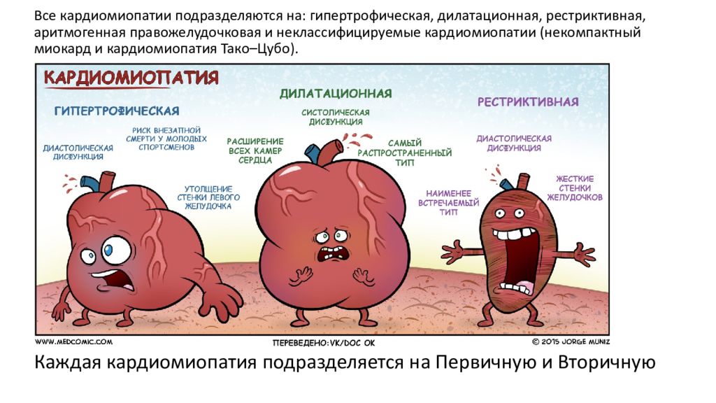 Рестриктивная кардиомиопатия презентация