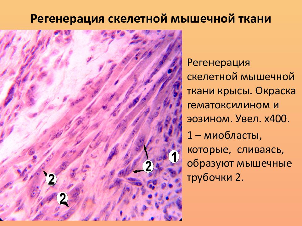 Регенерация тканей. Регенерация мышечной ткани патанатомия. Регенерация мышечной ткани гистология.