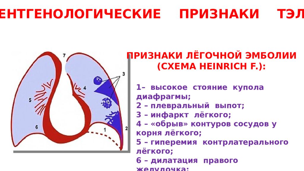 Спавшее легкое. Сегментарные ветви легочной артерии. Правая легочная артерия делится. Легочная артерия выходит из. Тэла сегментарных ветвей легочной артерии.