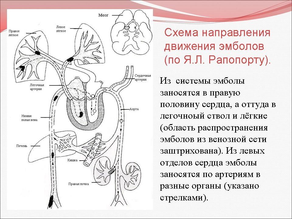 Нарушение кровообращения и лимфообращения патология презентация