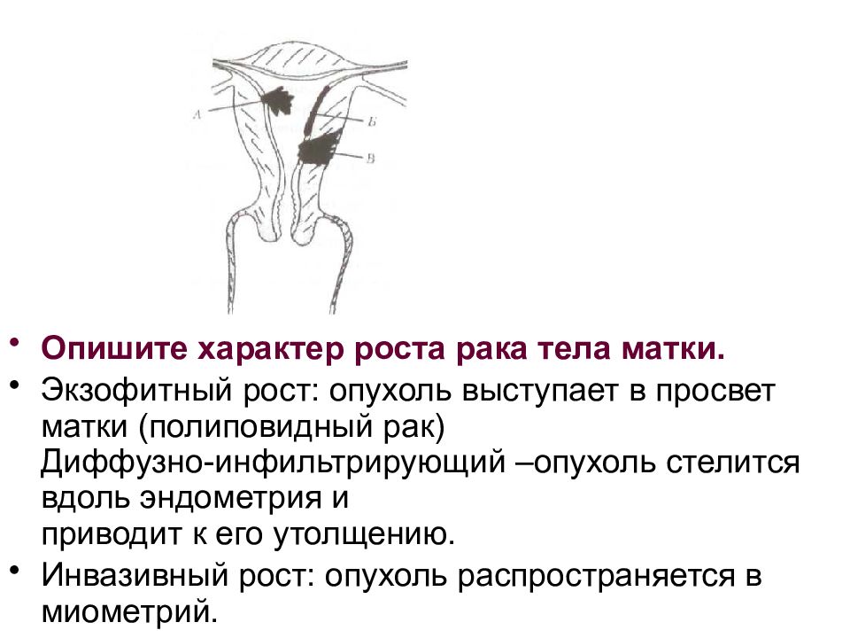 Рост матки. Экзофитная опухоль шейки матки. Экзофитная форма роста опухоли что это такое. Экзофитно растущее образование. Экзофитный рост опухоли.