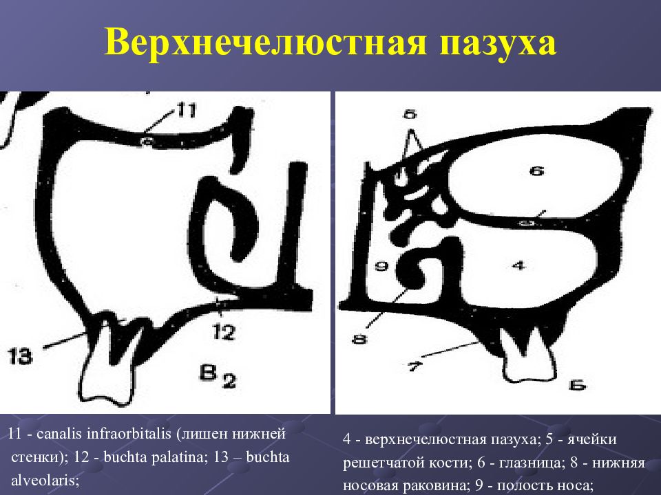 Верхнечелюстная пазуха. Строение стенок верхнечелюстной пазухи. Пневматический Тип строения верхнечелюстной пазухи. Типы строения верхнечелюстной пазухи. Строение стенок гайморовой пазухи.