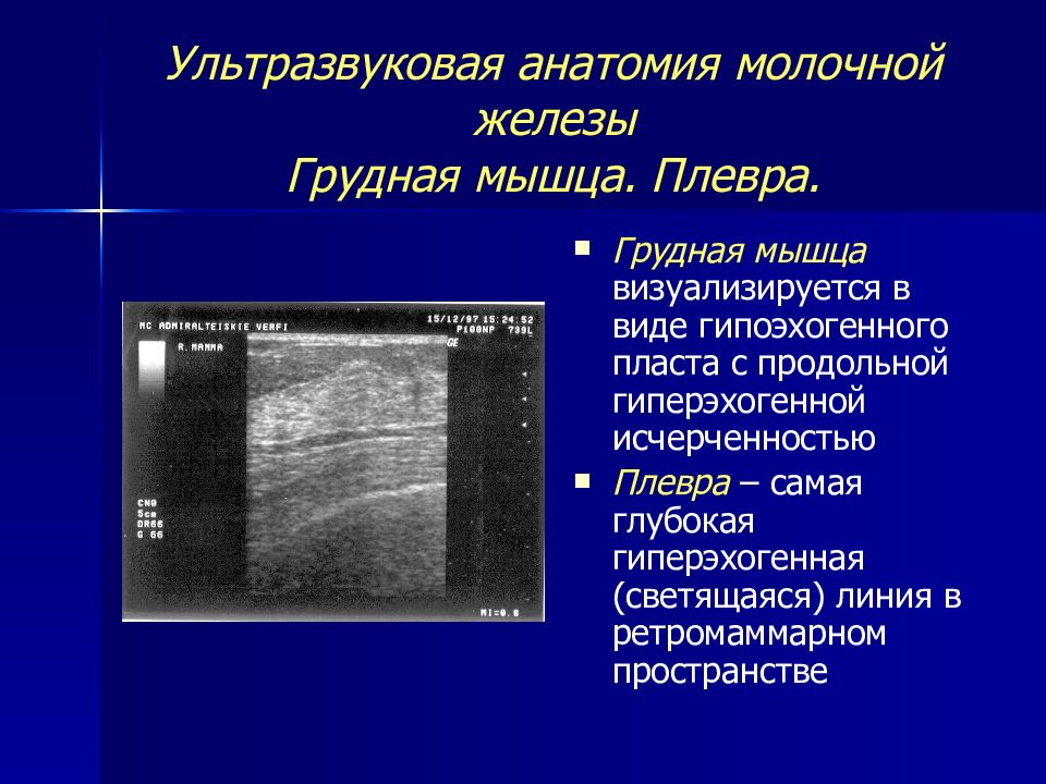 Узи молочной железы цикл. Структура молочной железы на УЗИ. Тип строения молочных желез УЗИ. Молочная железа УЗИ анатомия. Строение молочной железы у женщин на УЗИ.