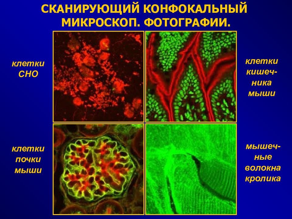 Изучение методов клеточной биологии. Конфокальная микроскопия клетки. Световая микроскопия клетки. Конфокальная световая микроскопия это. Конфокальная микроскопия это в гистологии.