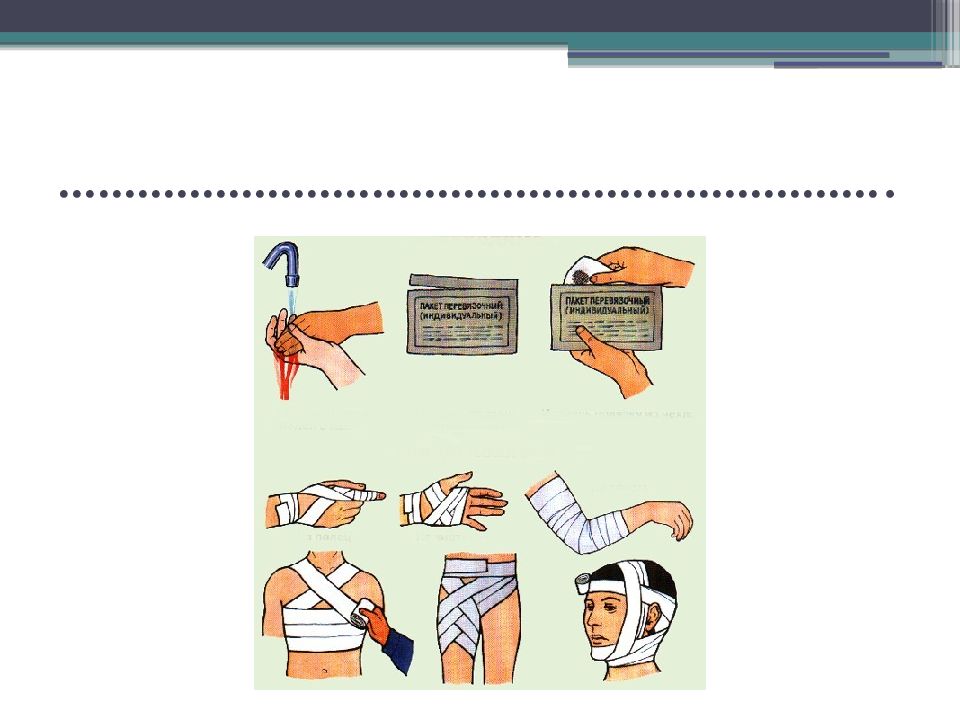 Правила наложения повязок презентация