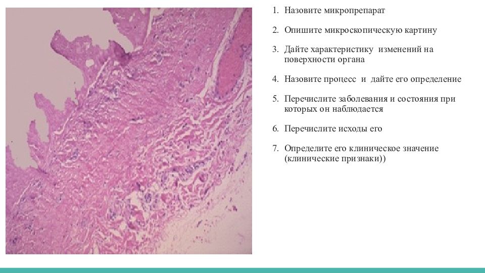 Крупозный трахеит микропрепарат рисунок