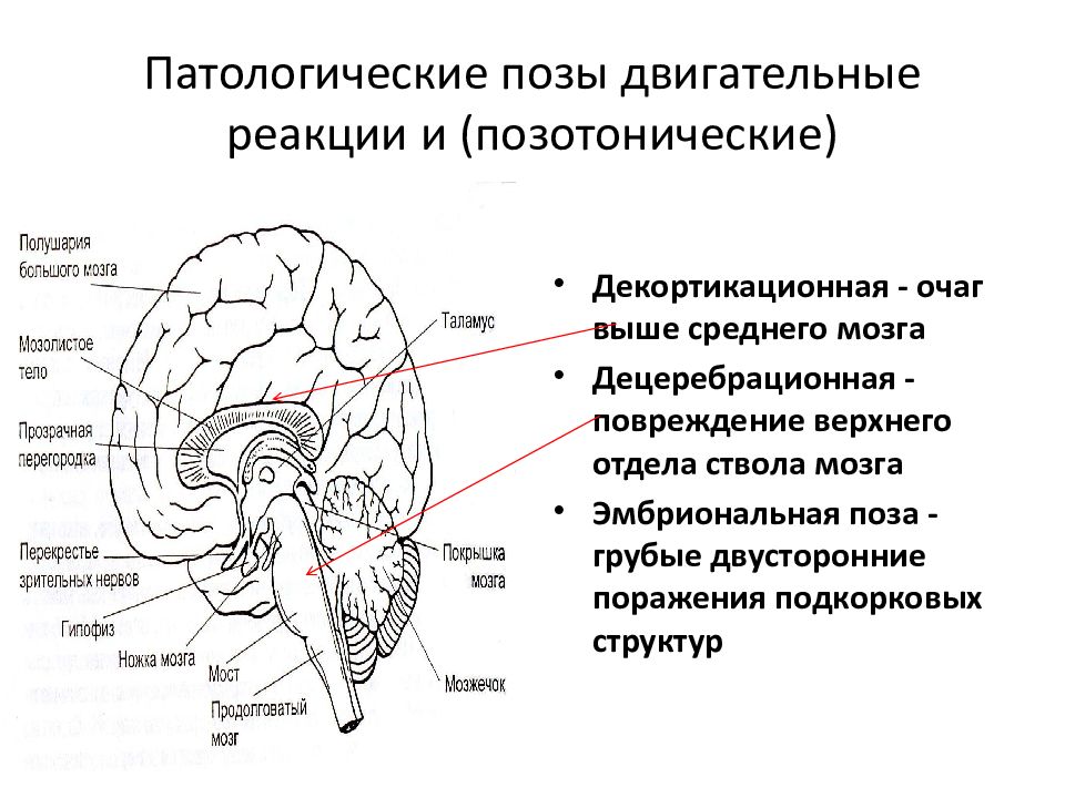 Прозрачная перегородка мозга. Прозрачная перегородка анатомия. Прозрачная перегородка мозга анатомия. Прозрачная перегородка Анат.