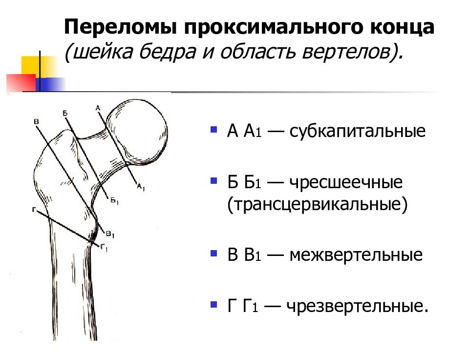 Презентация переломы бедренной кости