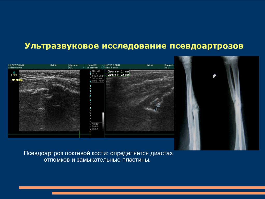 Амбулаторная травматология детского возраста презентация