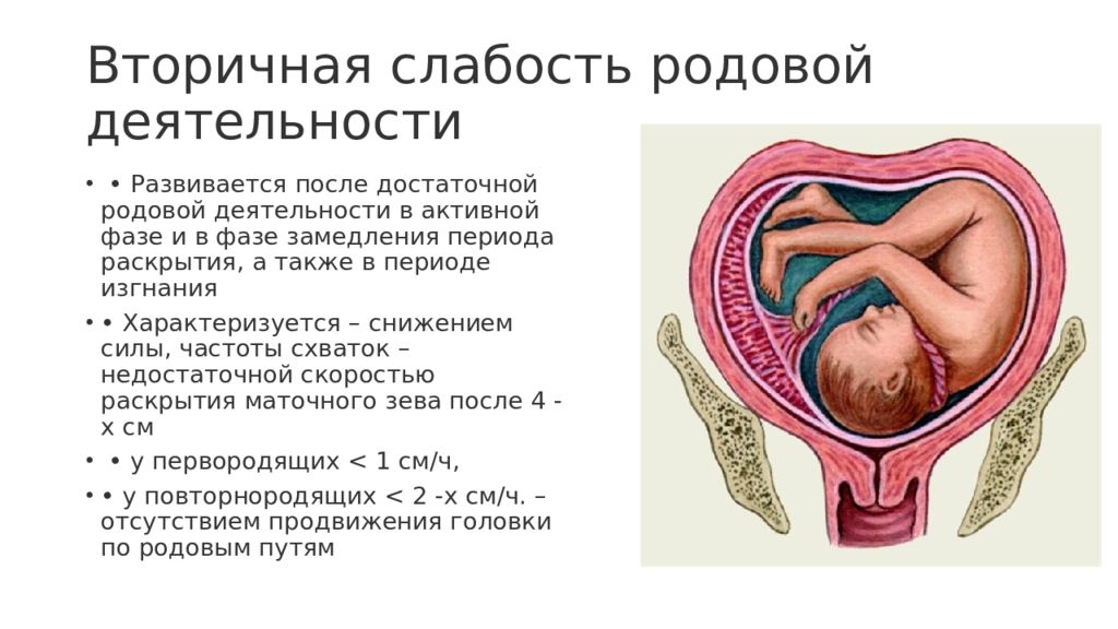 Схема ретровира в родах