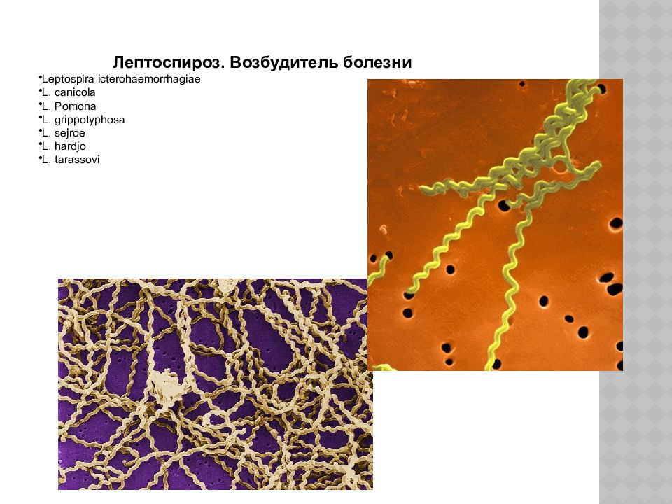 Возбудитель болезни. Лептоспироз возбудитель - лептоспира. Лептоспироз Ветеринария возбудитель. Спирохеты лептоспироз. Возбудитель лептоспироза микробиология.