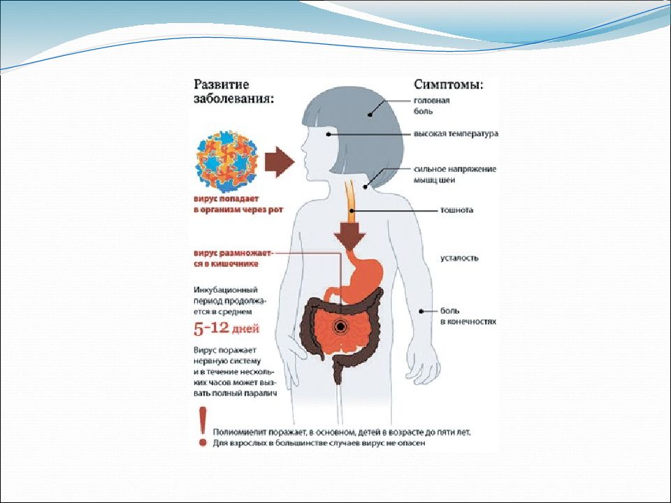 Полиомиелит презентация микробиология