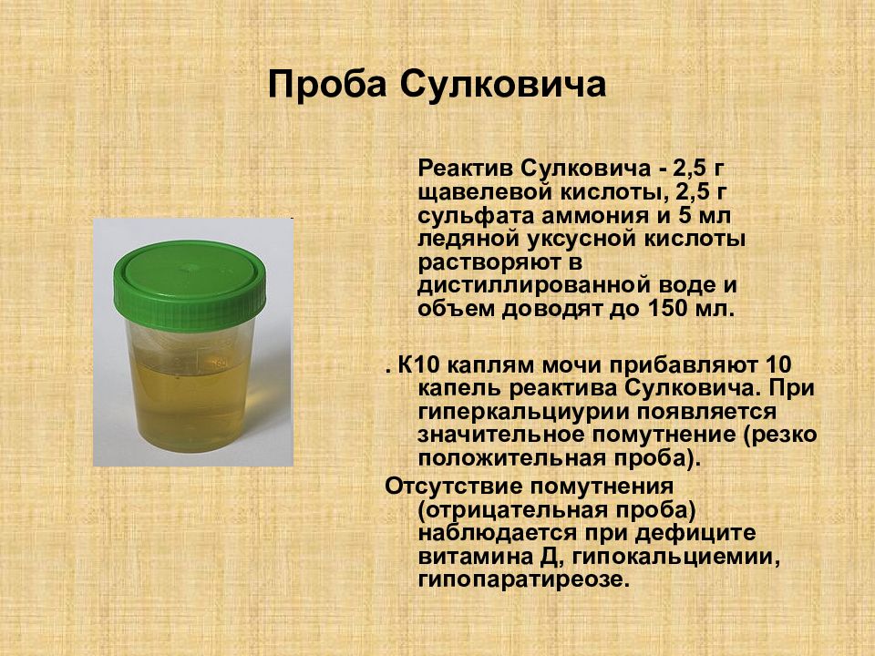 Сдать мочу ребенку. Методика постановки пробы Сулковича. Проба Сулковича при рахите у детей. Проба Сулковича методика проведения. Проба Сулковича показатели у детей.