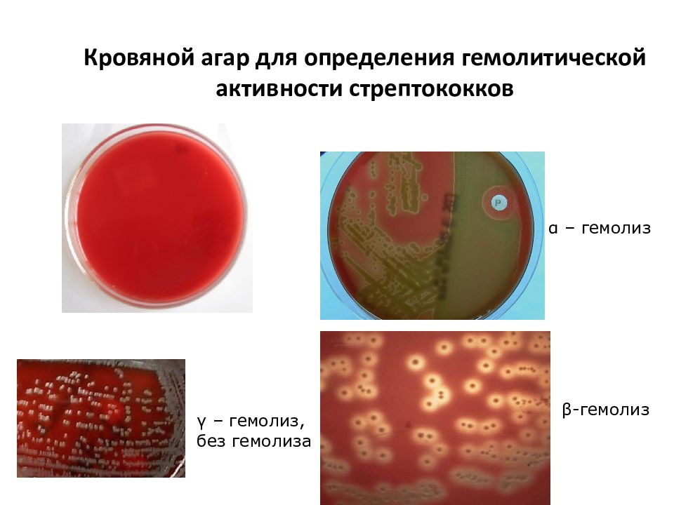 Стрептококки презентация микробиология