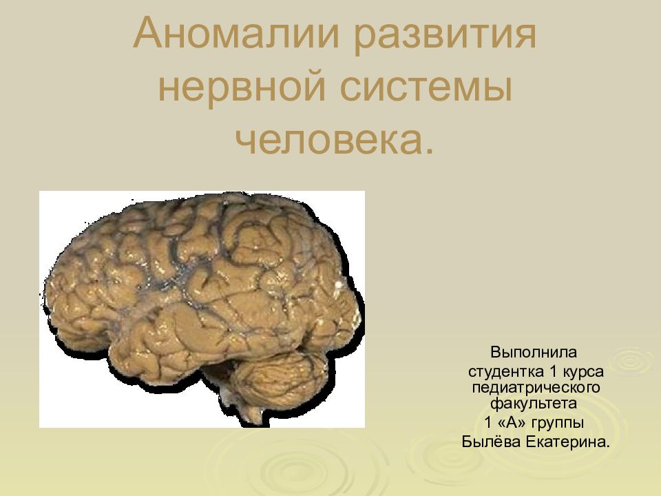 Аномалии развития нервной системы человека.