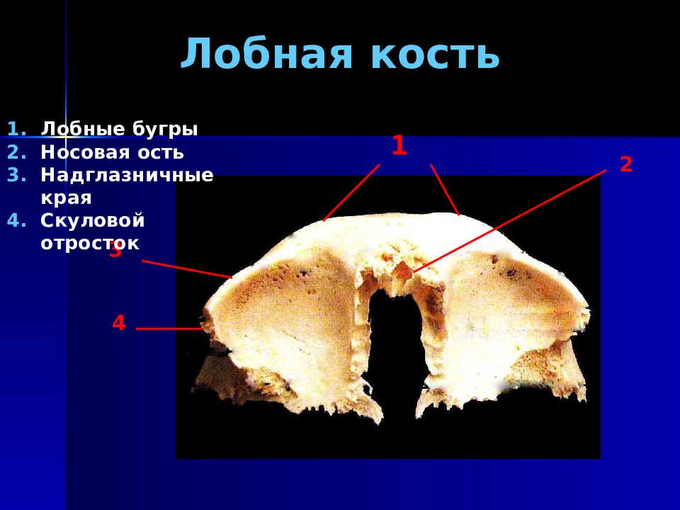 Лобная кость отростки. Носовой отросток лобной кости. Носовая ость лобной кости.