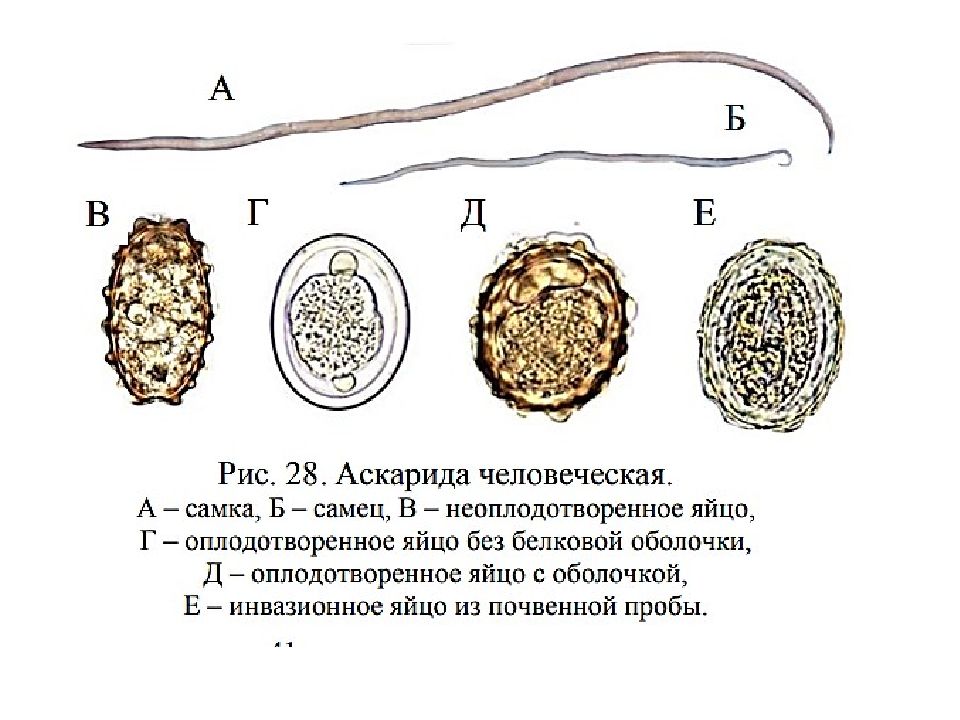 В каких органах личинки аскариды. Ascaris lumbricoides яйца строение. Аскарида человеческая строение яйца. Ascaris lumbricoides яйца микроскоп.