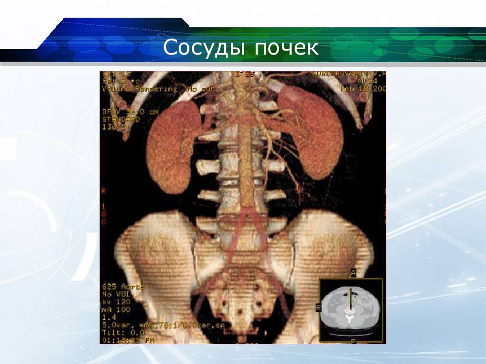 Кт почек презентация