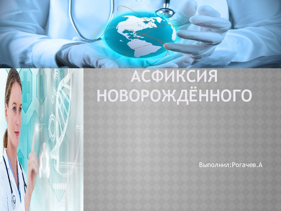 Асфиксия новорождённого
