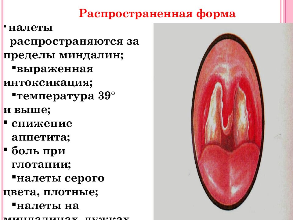 Распространенная форма