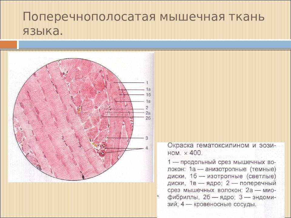 Поперечная мышечная ткань. Поперечнополосатая Скелетная мышечная ткань языка препарат. Поперечнополосатая Скелетная мышечная ткань гистология препарат. Поперечнополосатая мышечная ткань гистология. Поперечно полосатая мышечная ткань препарат.