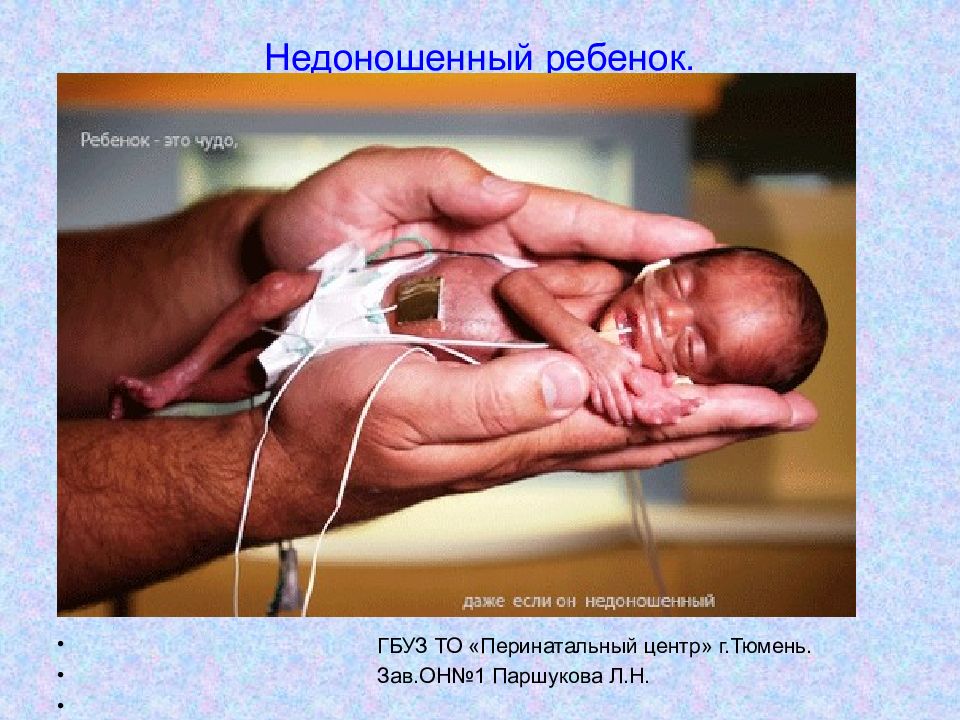 Недоношенный ребенок. ГБУЗ ТО «Перинатальный центр» г.Тюмень. Зав.ОН№1