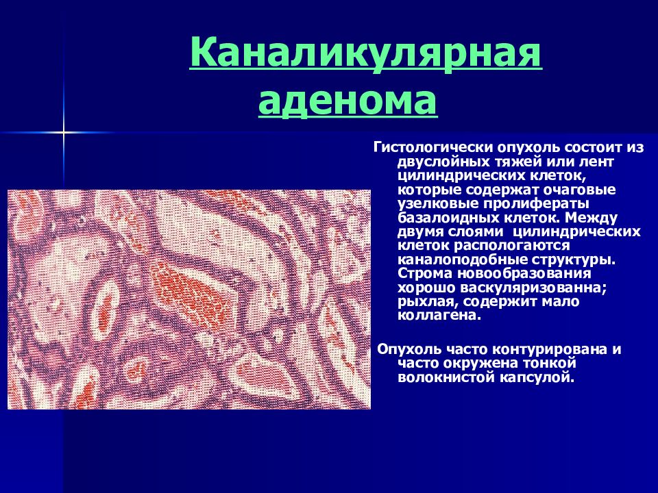 Опухоль презентация по патологии