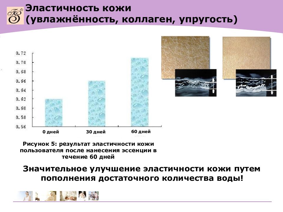 Эластичность кожи. Эластичность кожи обеспечивают. Нормальная эластичность кожи. Увлажненность кожи норма. Эластичность и упругость кожи зависят от.