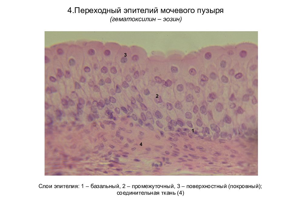 Переходный эпителий мочевого пузыря кролика под микроскопом рисунок с подписями