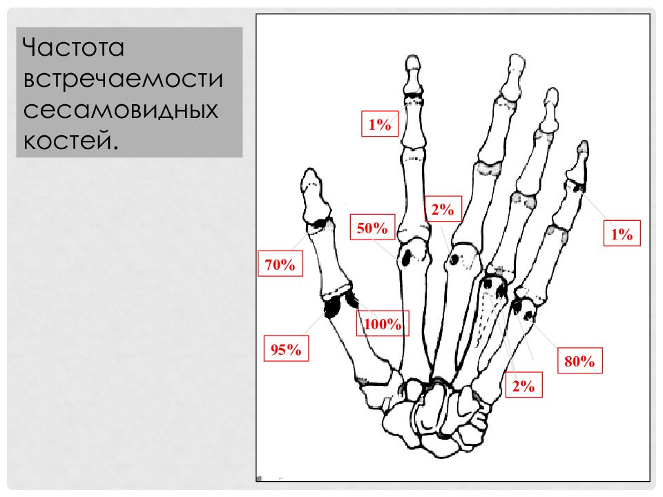 Сесамовидные кости. Сесамовидные кости 1 пальца кисти. Сесамовидные кости кисти анатомия. Сесамовидные кости кисти Королюк. Сесамовидные кости 1 пальца кисти рентген.