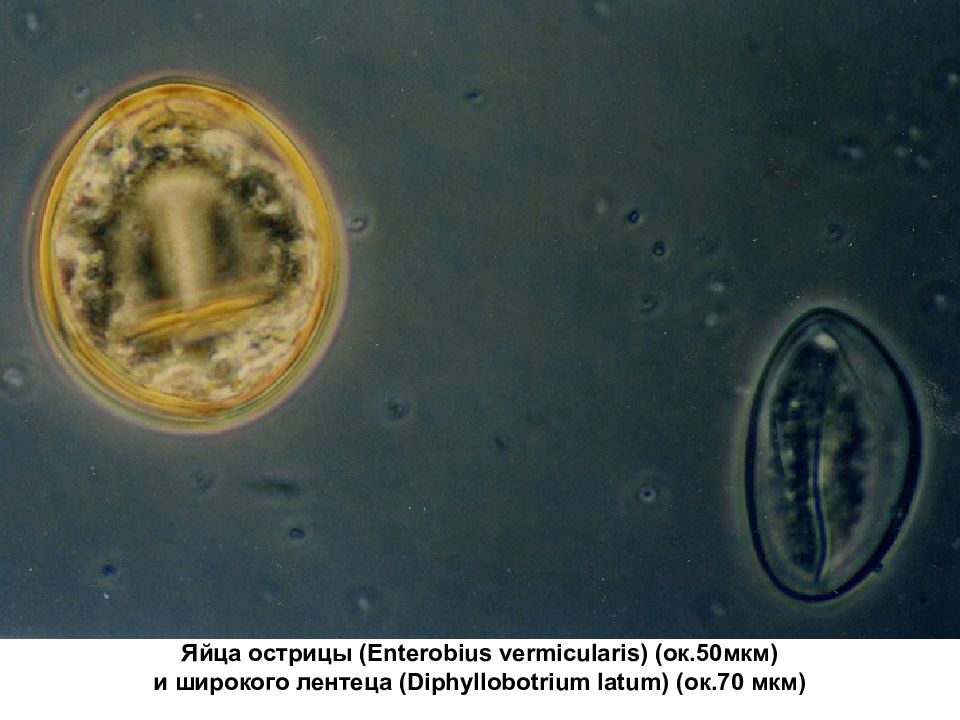 Острица фото под микроскопом. Enterobius vermicularis яйца. Enterobius vermicularis под микроскопом. 17. Enterobius vermicularis. Препарат. Яйца остриц под микроскопом.