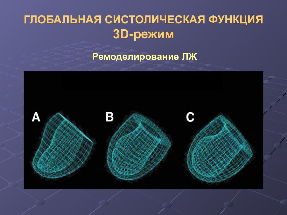 Функция 3д. Систолическая функция левого желудочка. Систолическая функция миокарда. Систолическая функция сердца