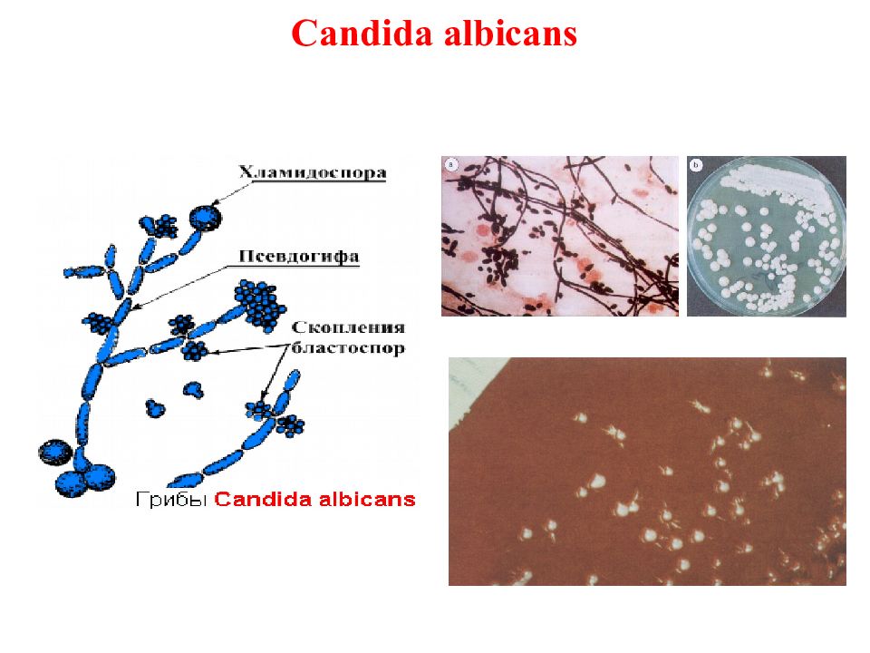 Кандидоз микробиология презентация