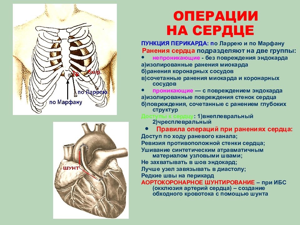 Топографическая анатомия сердца презентация