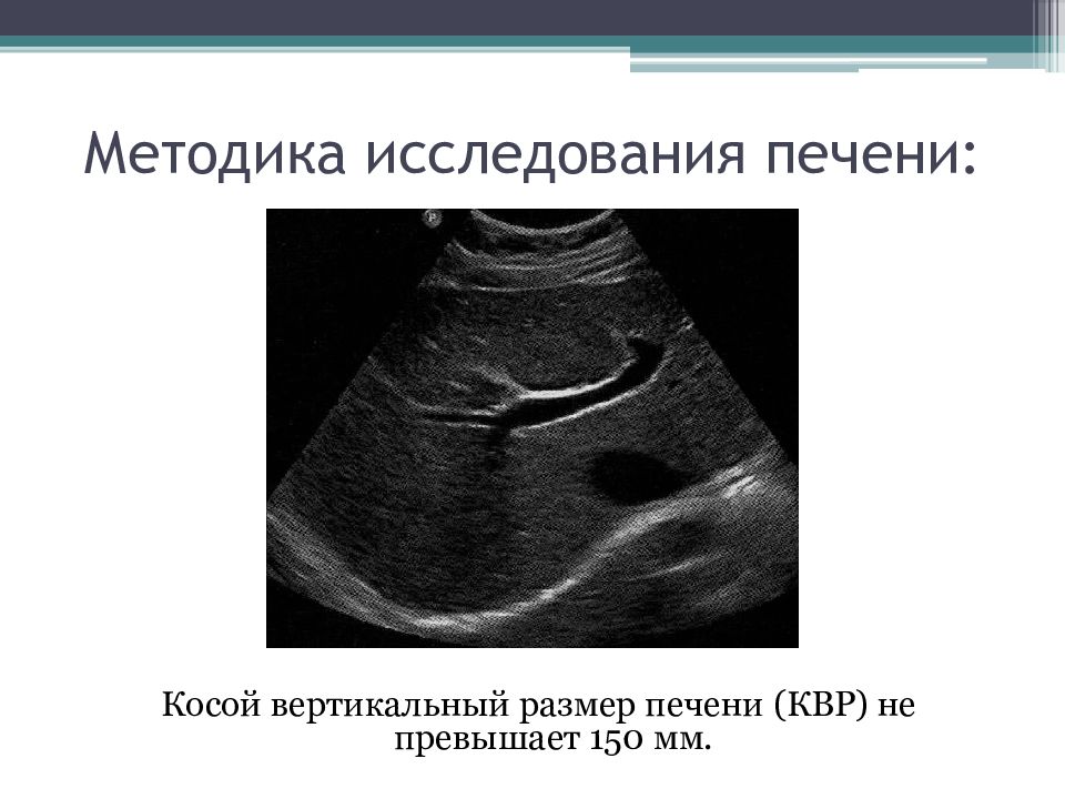 Очаговые поражения печени презентация