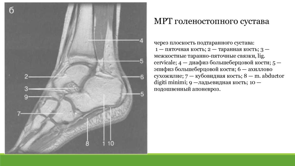 Мрт голеностопного. Кт анатомия голеностопного сустава. Сухожилия голеностопного сустава мрт.