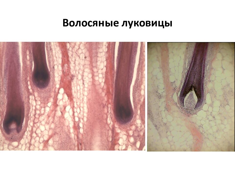 Волосяные луковицы