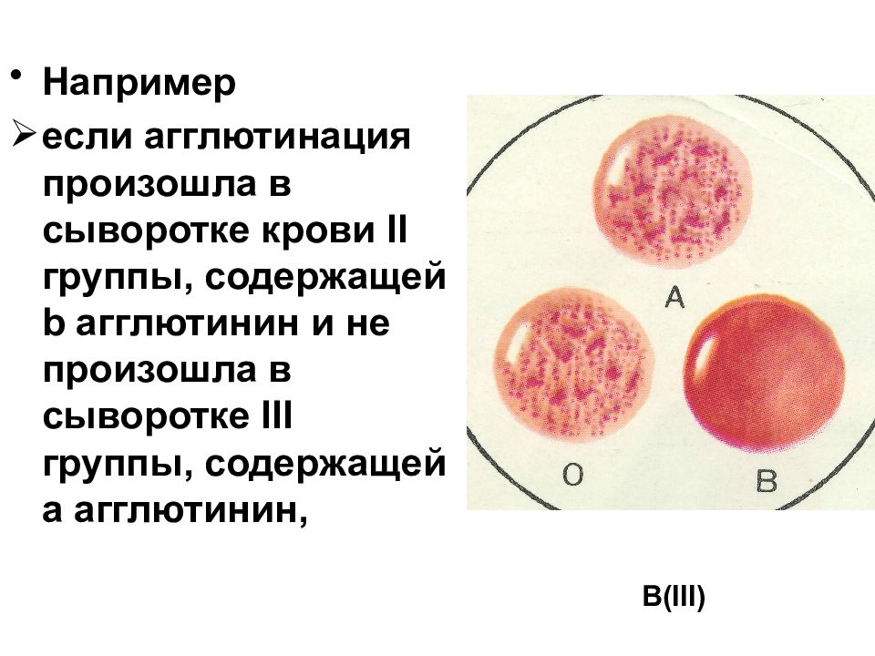 Группа крови агглютинация картинки