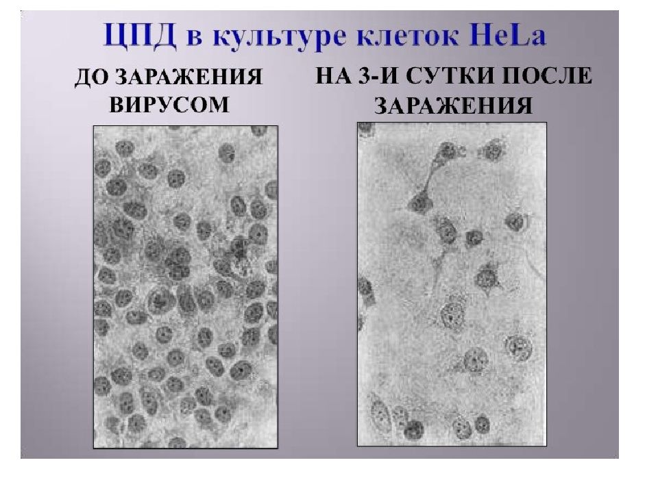 Нормальная клетка. ЦПД вируса полиомиелита на культуру клеток. ЦПД вируса полиомиелита на культуру клеток hela. Культура клеток hela микробиология.