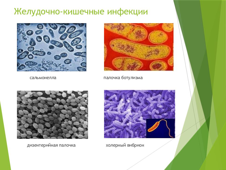 Ботулизм презентация по гигиене