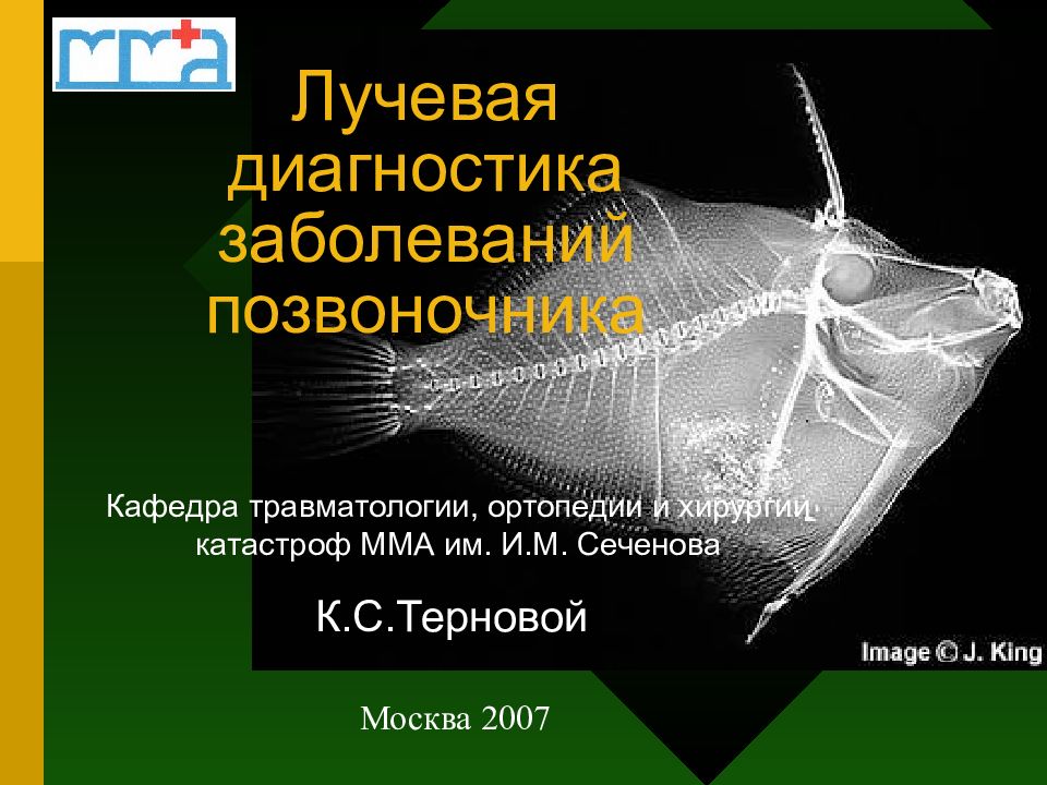 Лучевая диагностика заболеваний позвоночника