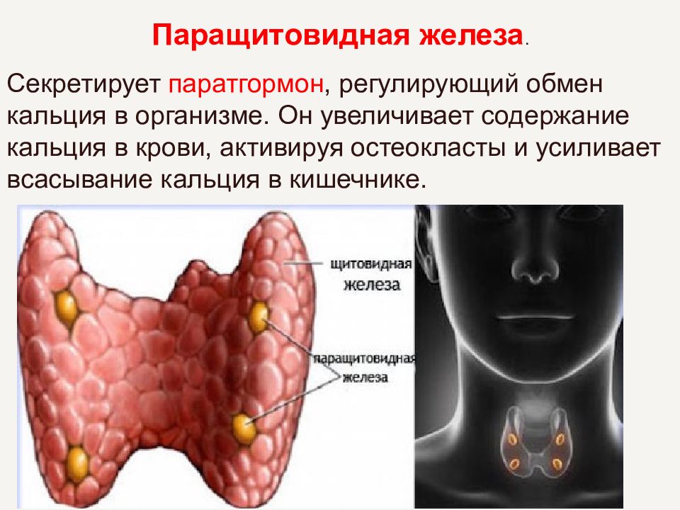 Презентация заболевания паращитовидных желез